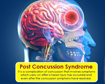 post-concussion-syndrome